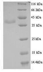 Minor capsid protein VP2, BK polyomavirus, recombinant