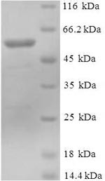 DDB1- and CUL4-associated factor 7 (DCAF7), human, recombinant