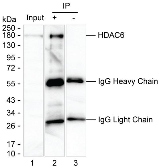 Anti-HDAC6