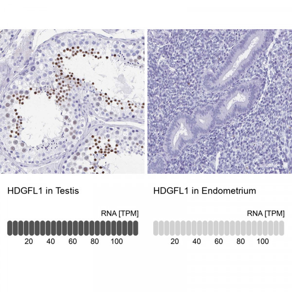 Anti-HDGFL1