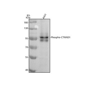 Anti-phospho-p120 Catenin (Tyr228) / CTNND1, clone 32C33