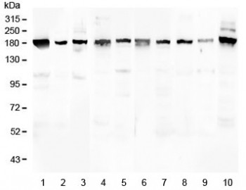 Anti-PCDH15 / Protocadherin 15