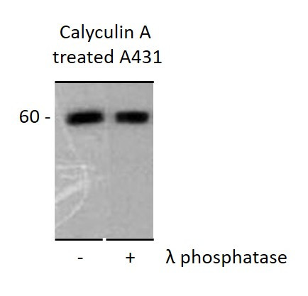 Anti-CORO1B