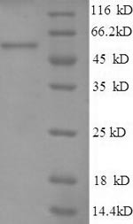 Heat shock protein 75 kDa, mitochondrial (TRAP1),partial, human, recombinant