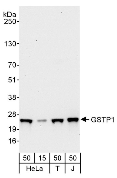 Anti-GSTP1