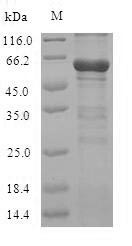 Cystathionine beta-synthase (Cbs), mouse, recombinant