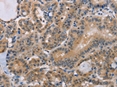 Anti-BTG1