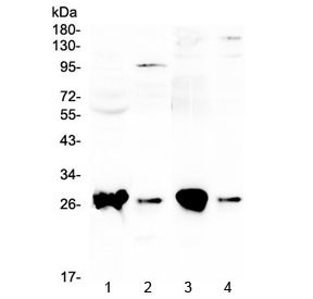 Anti-GSTT1 / Glutathione S Transferase theta 1