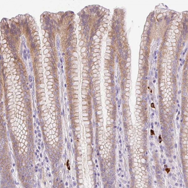 Anti-LHFPL5