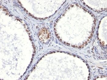 Anti-Androgen Receptor, clone AR441