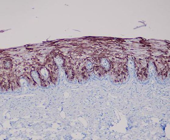 Anti-Cytokeratin 10, clone SQab18104