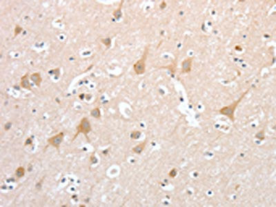 Anti-PCDHB16