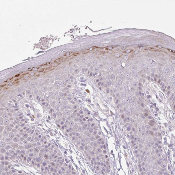 Anti-ZNF814