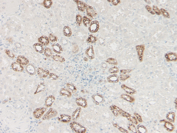 Anti-BD-1 / beta Defensin-1