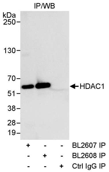 Anti-HDAC1
