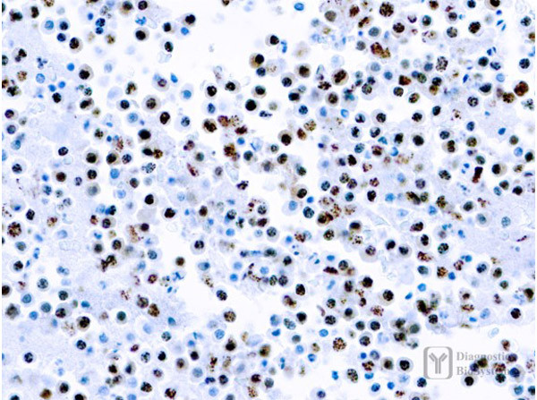 Anti-Herpesvirus 8, clone LN53
