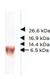 Anti-BNP, clone 24C5