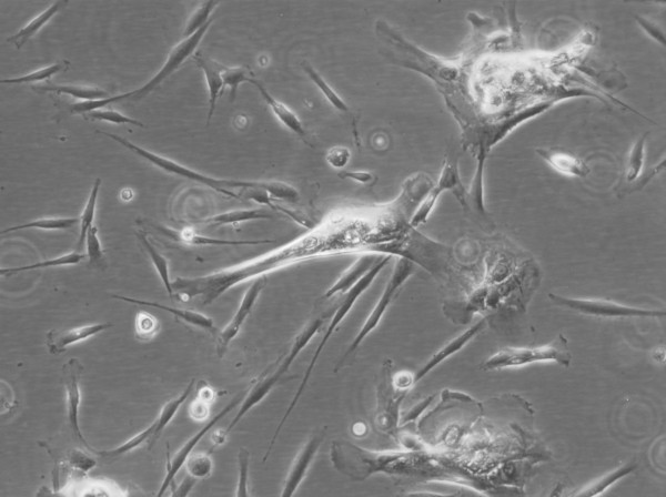 Human Dental Follicle stem Cells (hDFSC) Cells