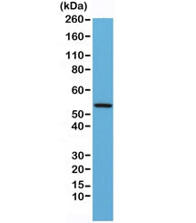 Anti-Desmin, clone RM234 (recombinant antibody)