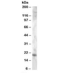 Anti-Cystatin F