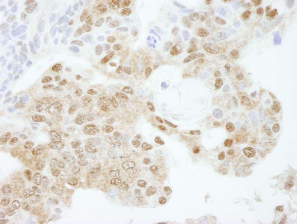 Anti-KPNA3 (IHC)