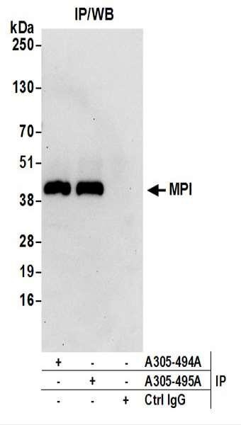 Anti-MPI