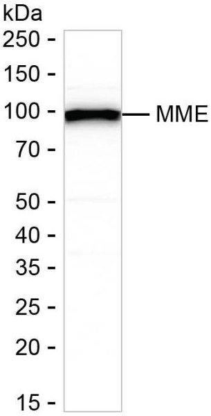 Anti-CD10