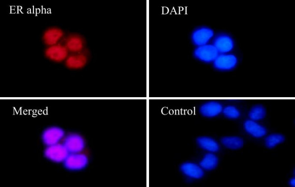Anti-ER alpha, clone SQab1889