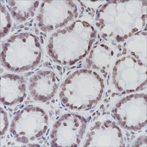 Anti-Recombinant ERCC1, clone A216
