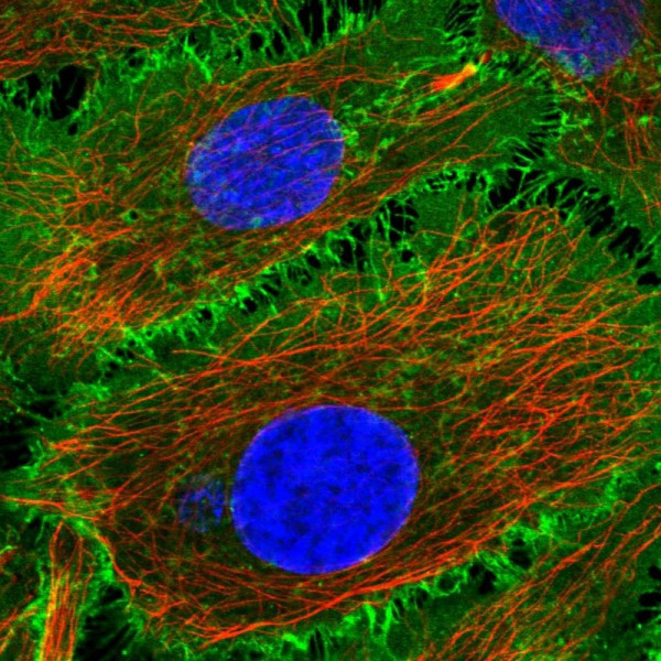 Anti-BASP1