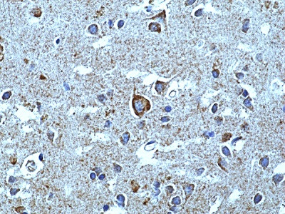 Anti-alpha-synuclein (SYUA), Rabbit Monoclonal (RM492)