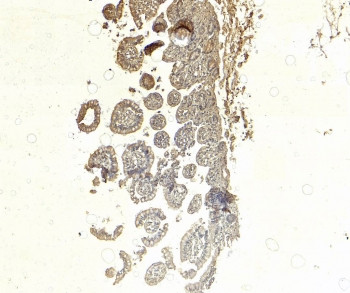 Anti-SGLT1 / Sodium/glucose cotransporter 1