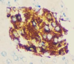 Anti-Ornithine Decarboxylase