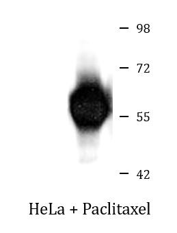 Anti-phospho-Vimentin (Ser56)