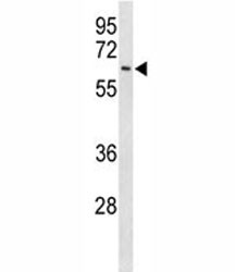 Anti-EIF2A