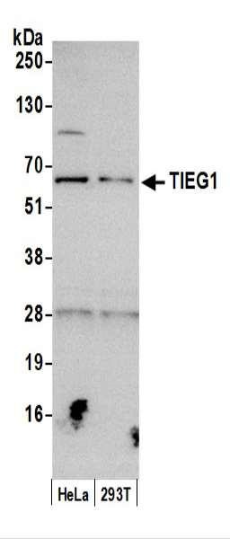 Anti-TIEG1