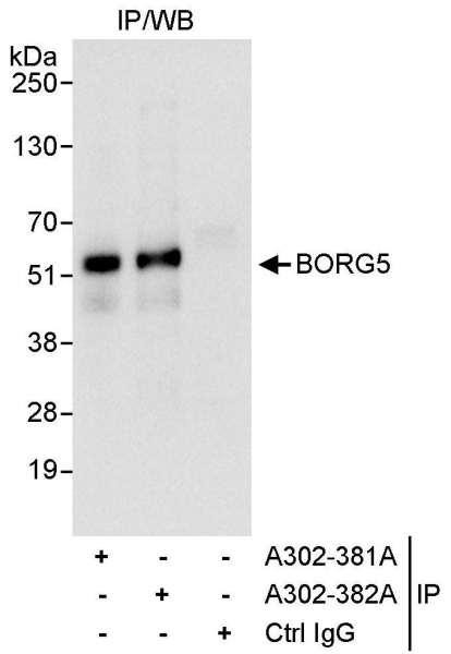 Anti-BORG5