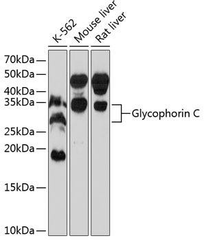 Anti-Glycophorin C (GYPC)