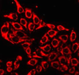 Anti-Hsp 60