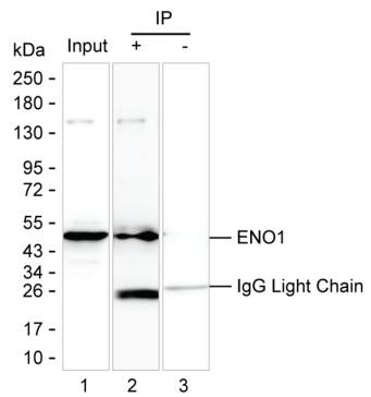 Anti-ENO1