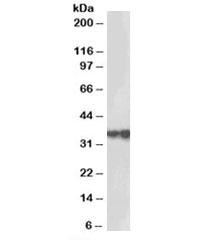 Anti-HSD17B3