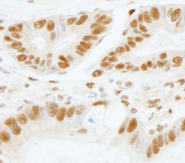 Anti-SF3b155/SAP155 (IHC)