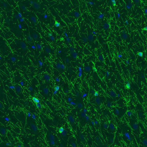 Anti-CNP, clone CL2872