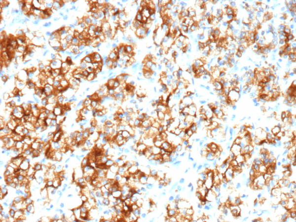Anti-Renal Cell Carcinoma (Carbonic Anhydrase IX), recombinant antibody, clone rPN-15