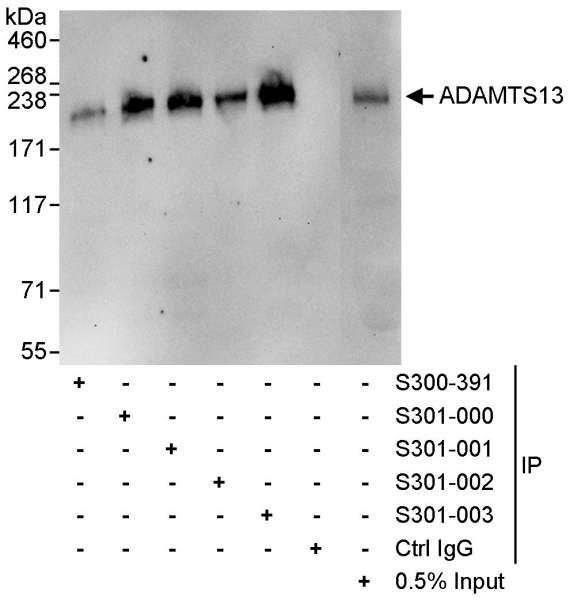 Anti-ADAMTS13