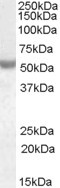 Anti-NOVA1, Internal