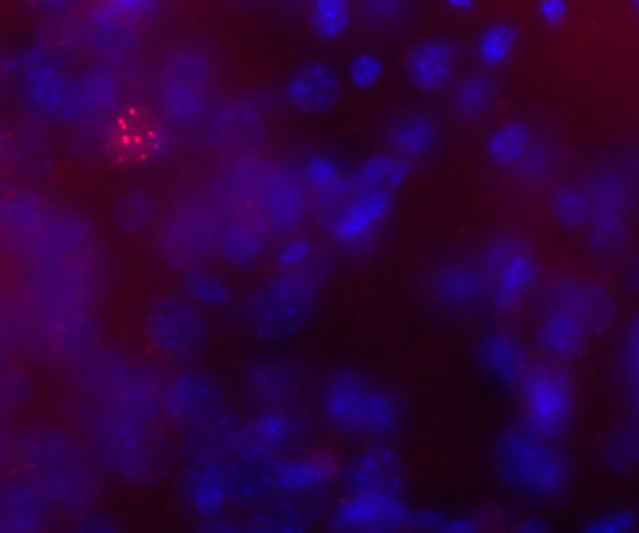 Anti-phospho-MeCP2 (Ser421), clone 2E2