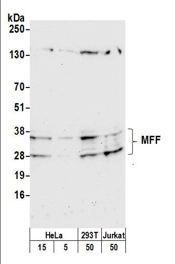 Anti-MFF