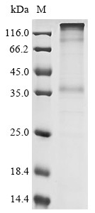Psychosine receptor (GPR65), human, recombinant