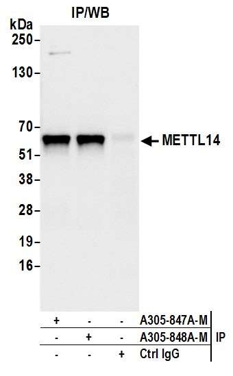 Anti-METTL14